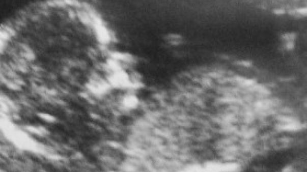 06-280x280